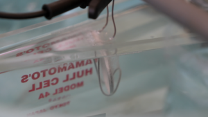 Close-up of IV tubing and a transparent medical container in a hospital, with the label text blurred